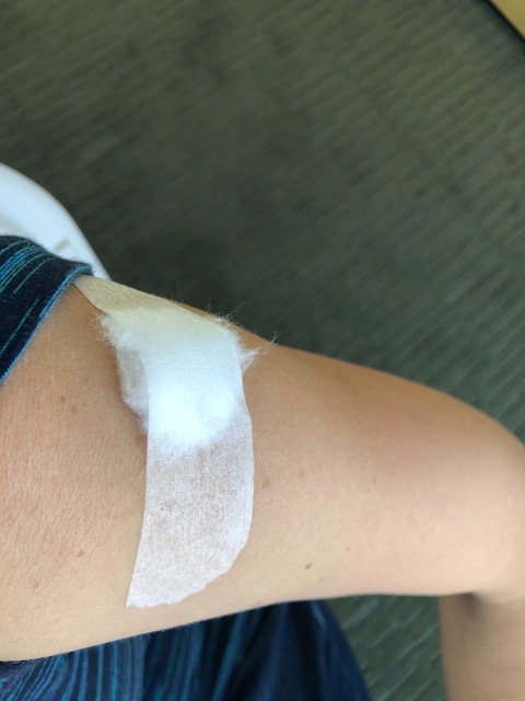 My arm after I got my first dose!