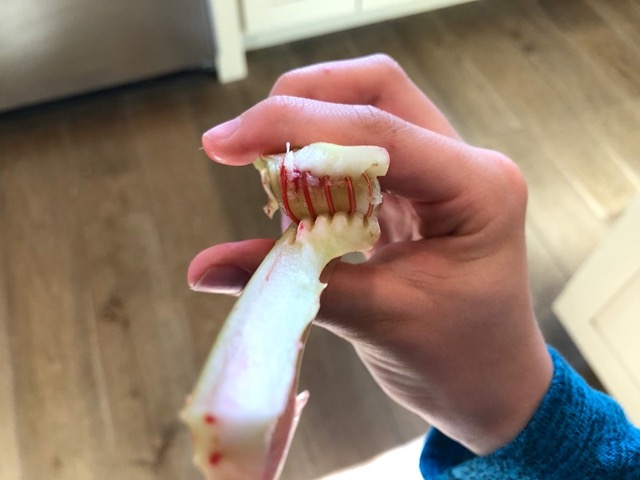 Look at the tubules where the dye climbed!