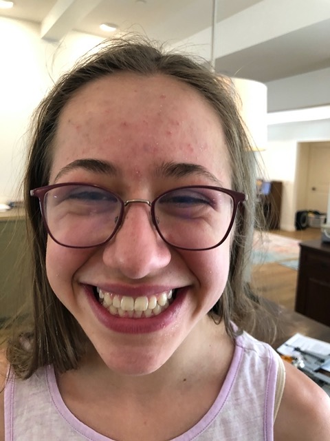 Ellie got her braces off!