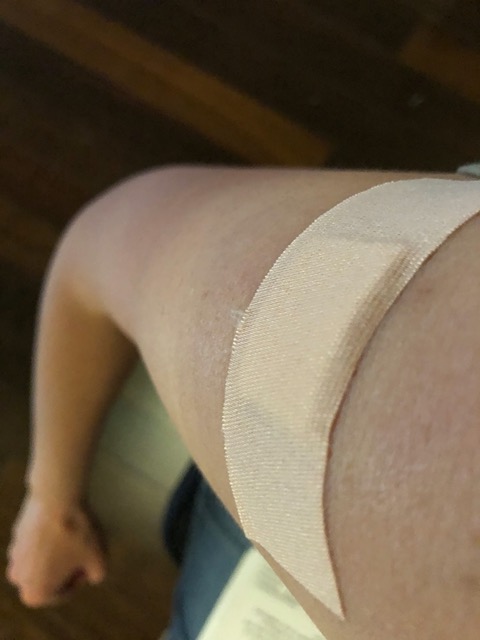 My arm after the second shot