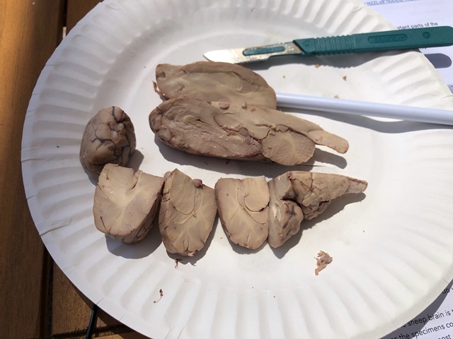 Close up of the brain sections